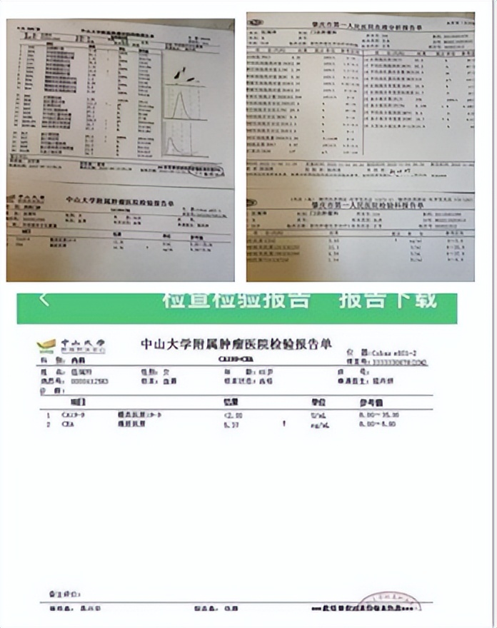 陈海林治疗癌症,陈海林肿瘤名医