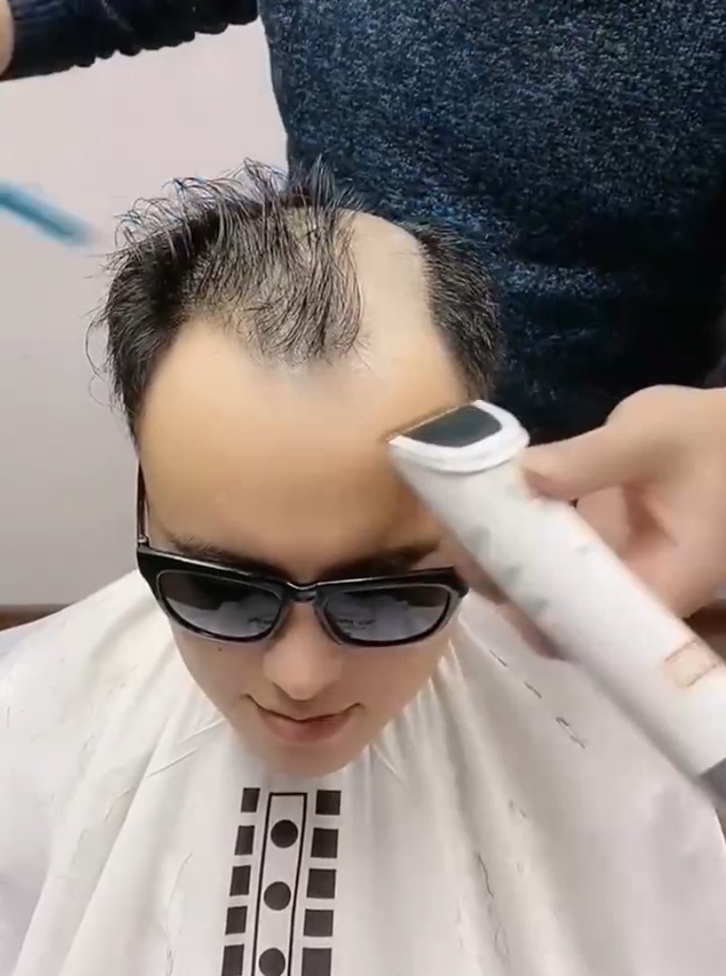 男士补发假发硬怎么办,购买男士假发如何避坑