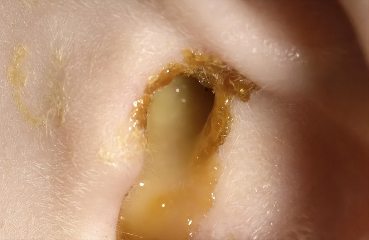 耳朵里面发痒怎么回事怎么去治疗,耳朵里面有黄色分泌物有臭味发痒