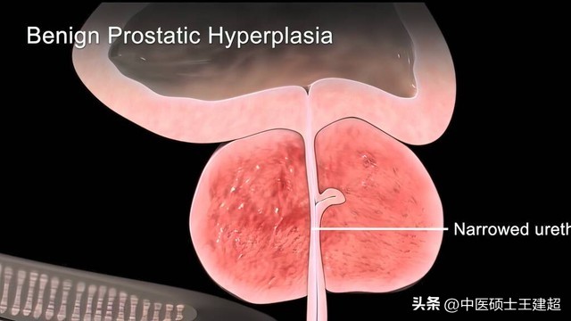 从排尿就可以看寿命长短,寿命长短看排尿