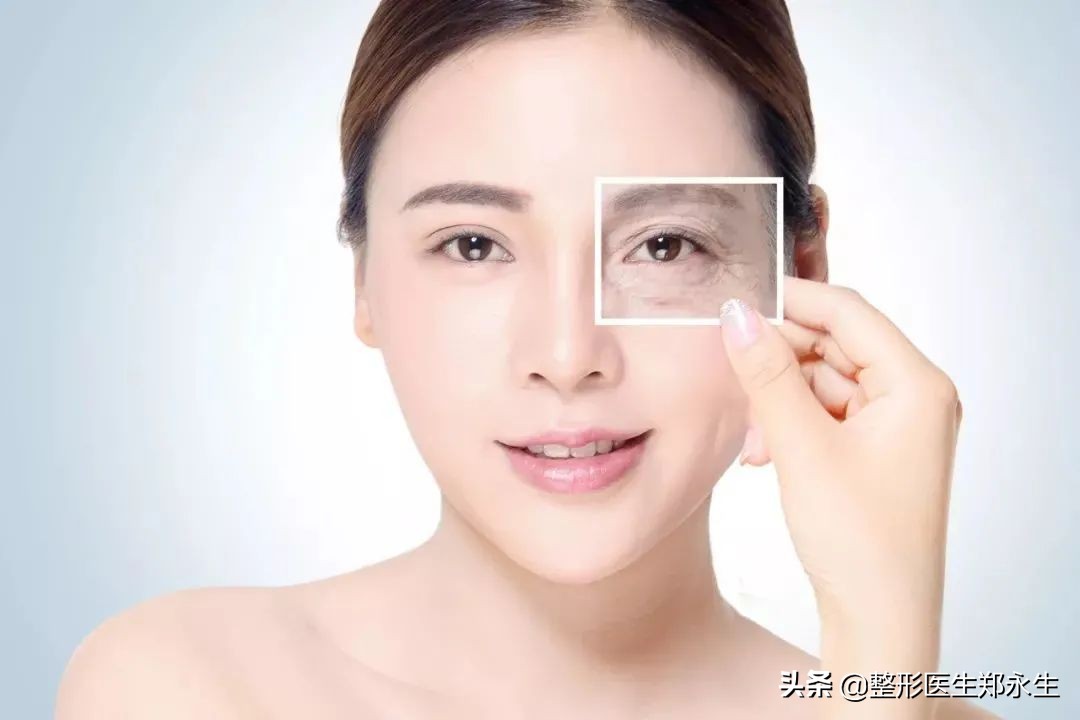 激光祛面部皱纹能保持多久,面部皱纹去除拉皮可以保持多久