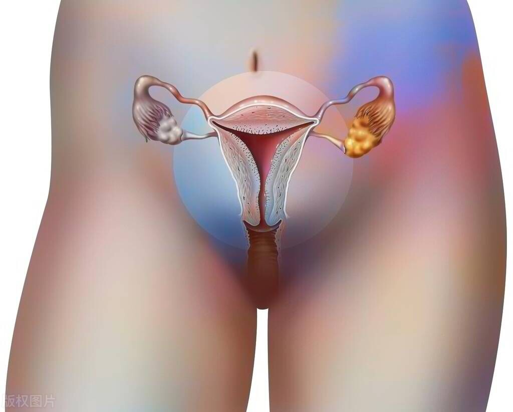 要小心是宫颈癌征兆,女人得宫颈癌的6个征兆