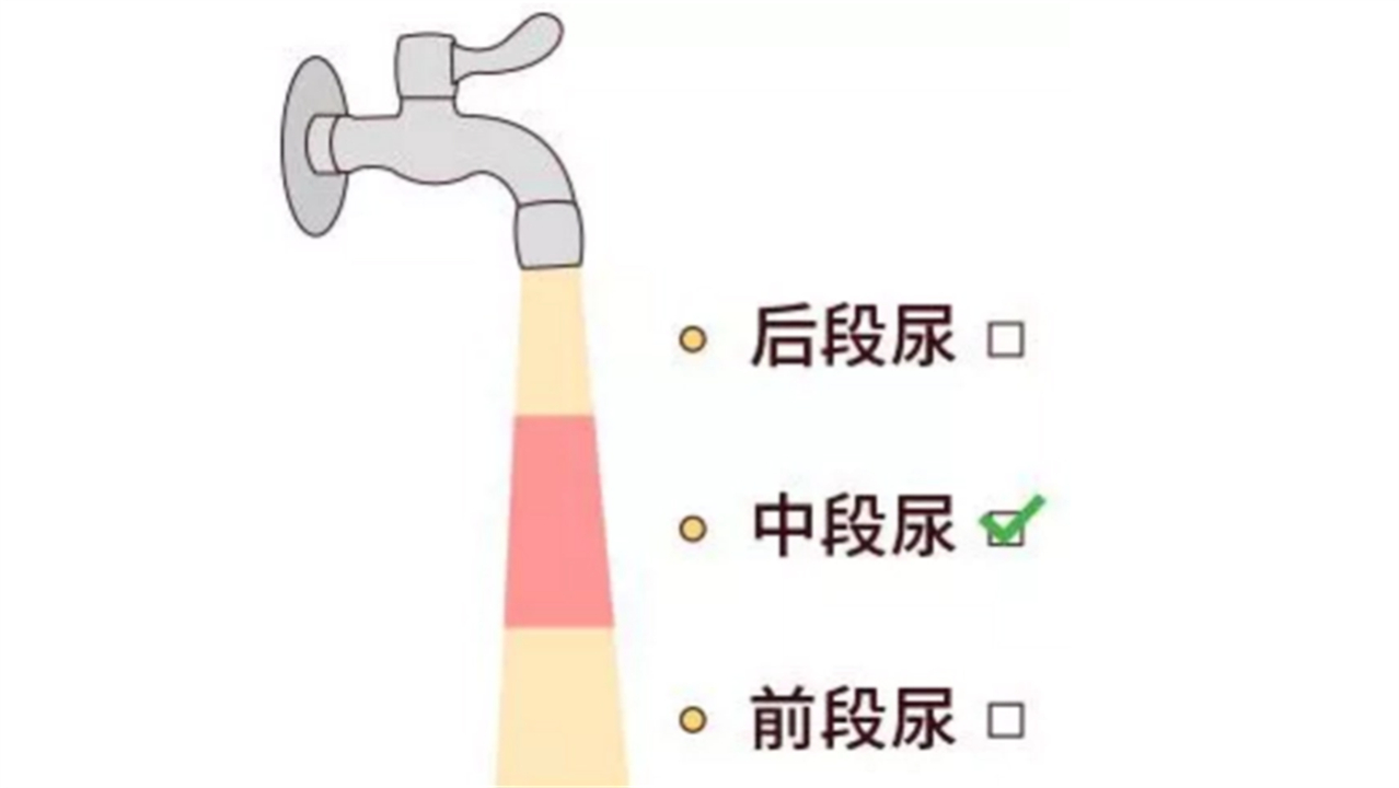 泌尿系统的彩超检查是什么,腹部彩超及泌尿系统彩超注意事项