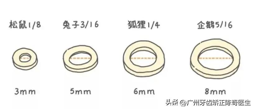 牙齿矫正橡皮筋怎么挂的,牙齿矫正橡皮筋用什么挂