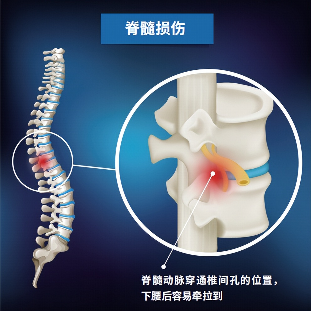 儿童跳舞下腰瘫痪训练,舞蹈下腰导致瘫痪的都是多大孩子