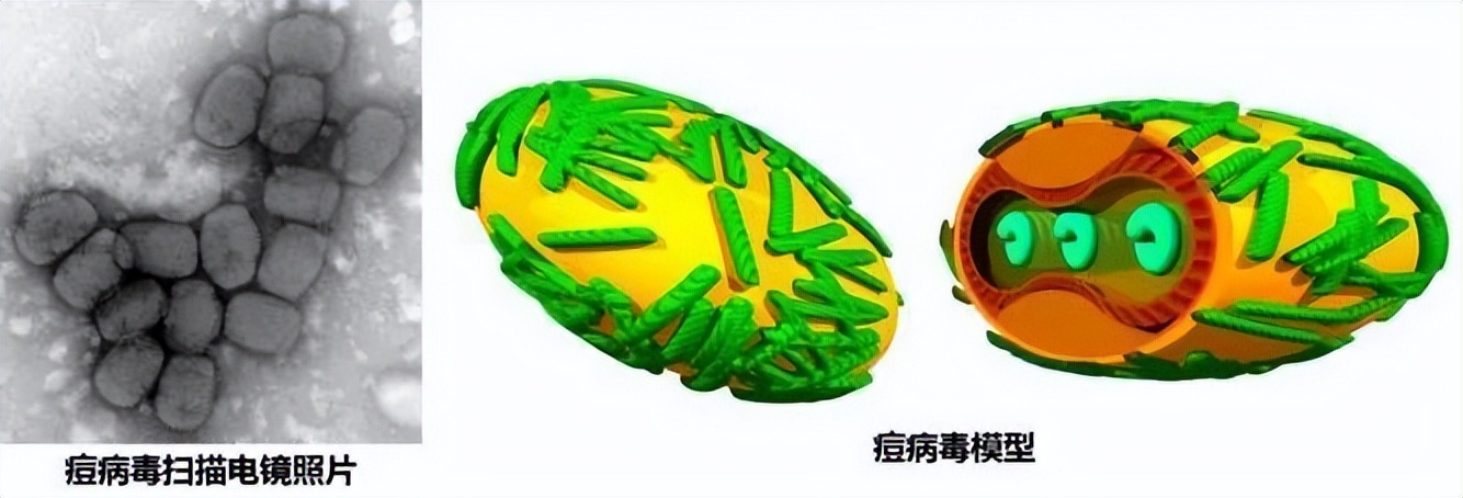 11个国家发现80多例猴痘，中国是否需要补种天花疫苗？