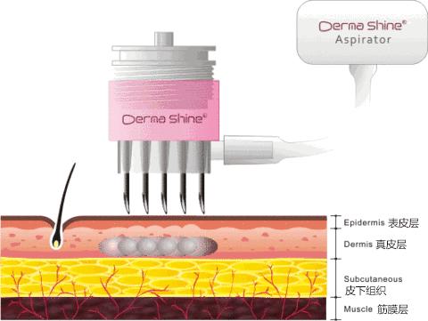 脸干有细纹显老,脸部皮肤黑显老怎么办