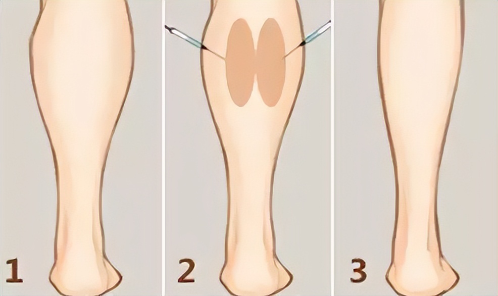 九院韦敏手术案例,九院韦敏聊整形