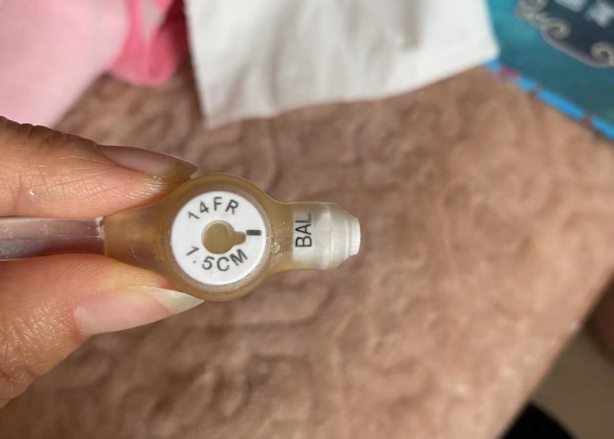 一针70万的救命药后续,70万一针救命药背后完整版