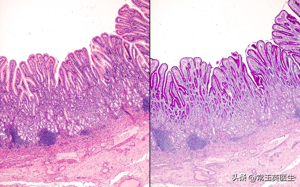 胃黏膜保护的中成药 (胃黏膜保护剂怎么卖)