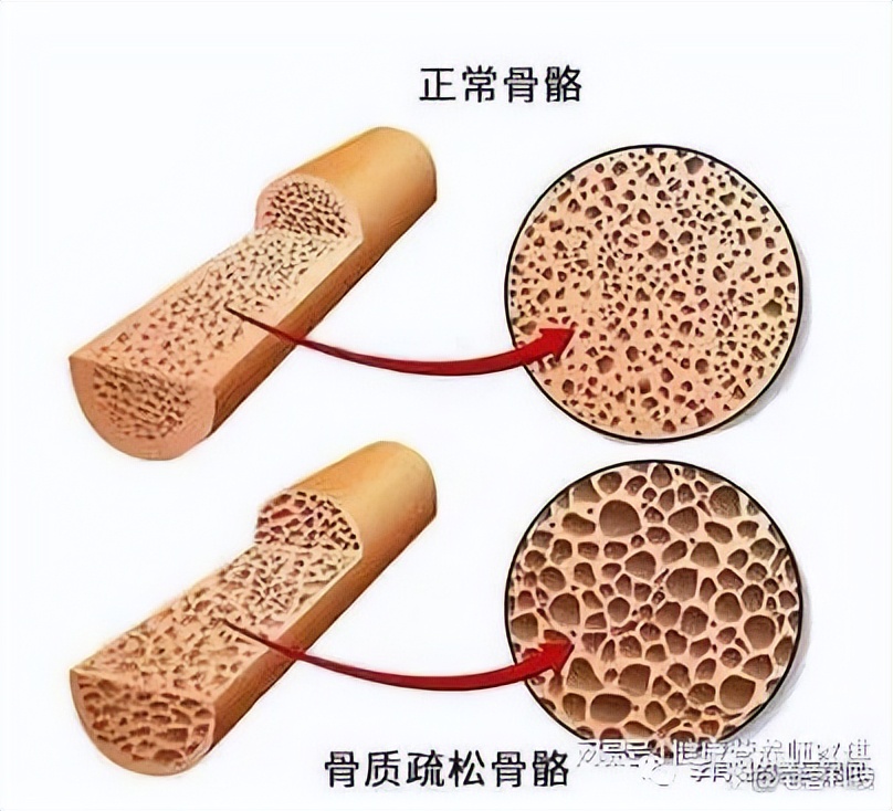 教你看懂检测报告,看懂体测报告中的骨骼肌与体脂
