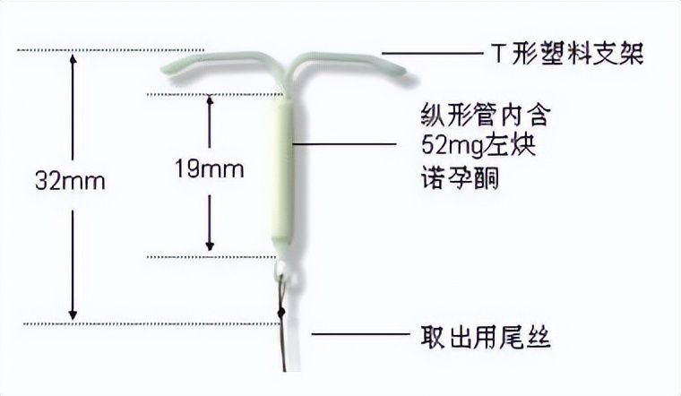 经期大量出血，痛到昏厥……还有救吗？