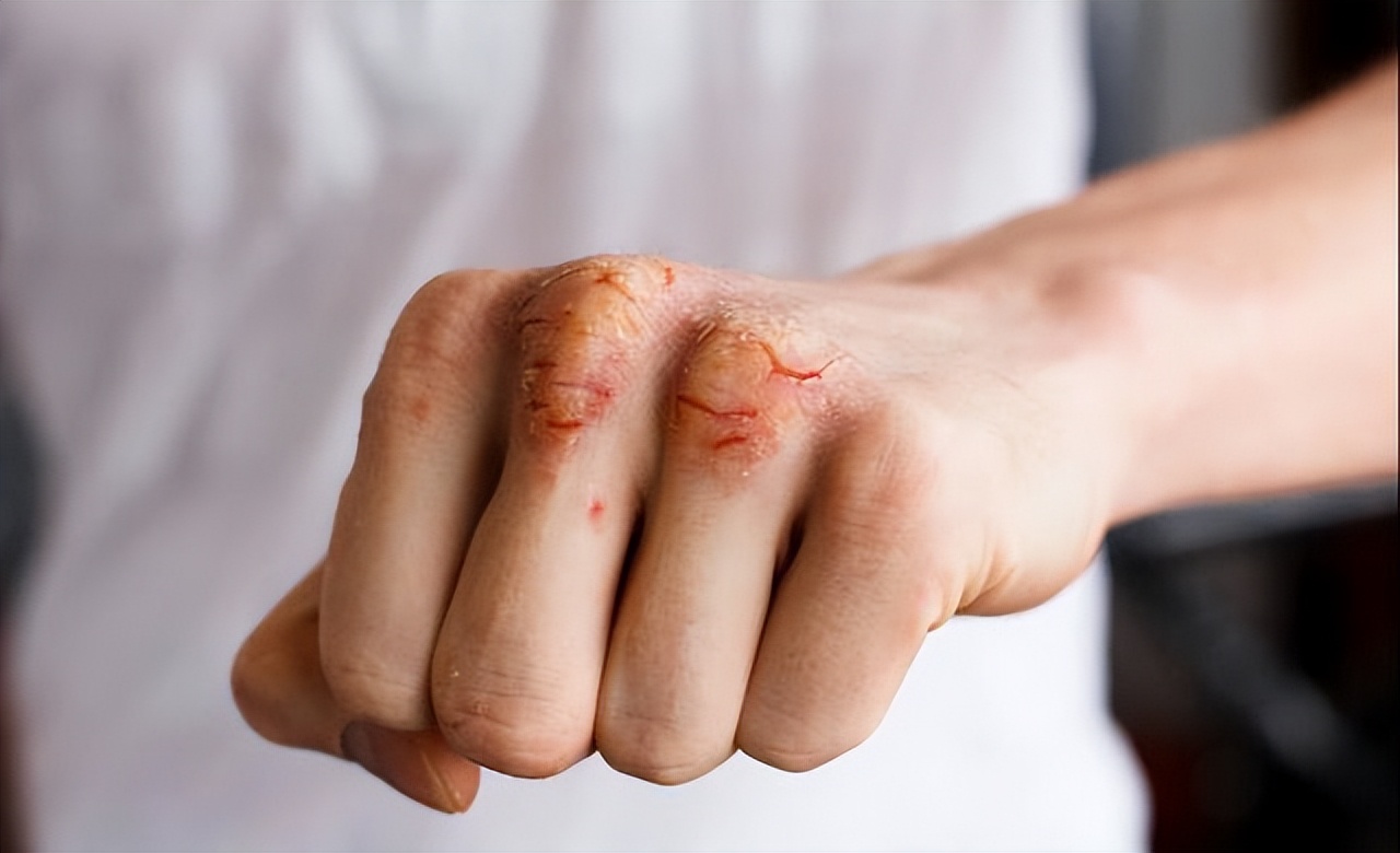 安宫牛黄丸一颗860元,安宫牛黄丸100多一颗是真的吗