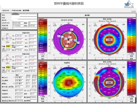 郑州眼科医院全飞秒设备,郑州视光眼科的仪器