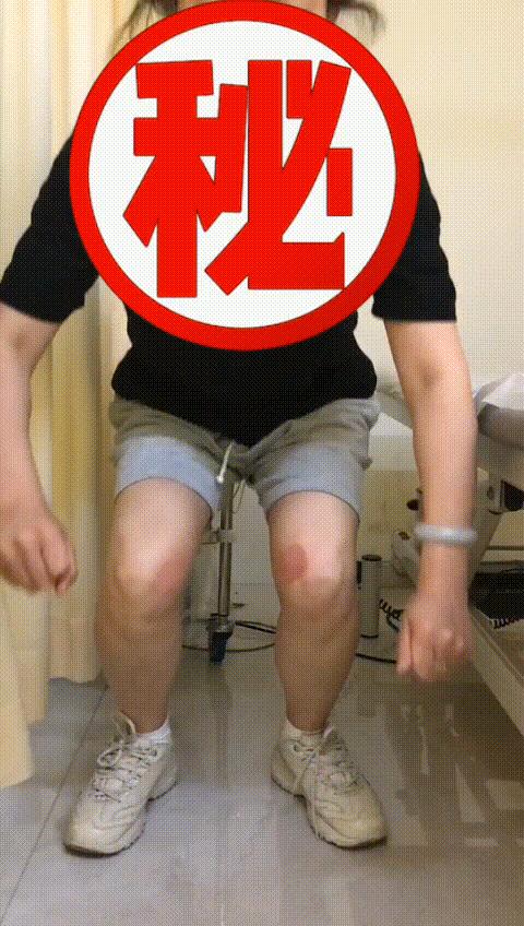 膝关节疼痛不是风湿是什么引起的,髌骨上移膝痛1分钟解决