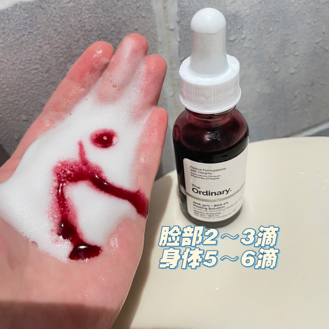 胳膊和大腿上的肥胖纹怎么能消掉,大腿有肥胖纹有十年了还能去掉吗