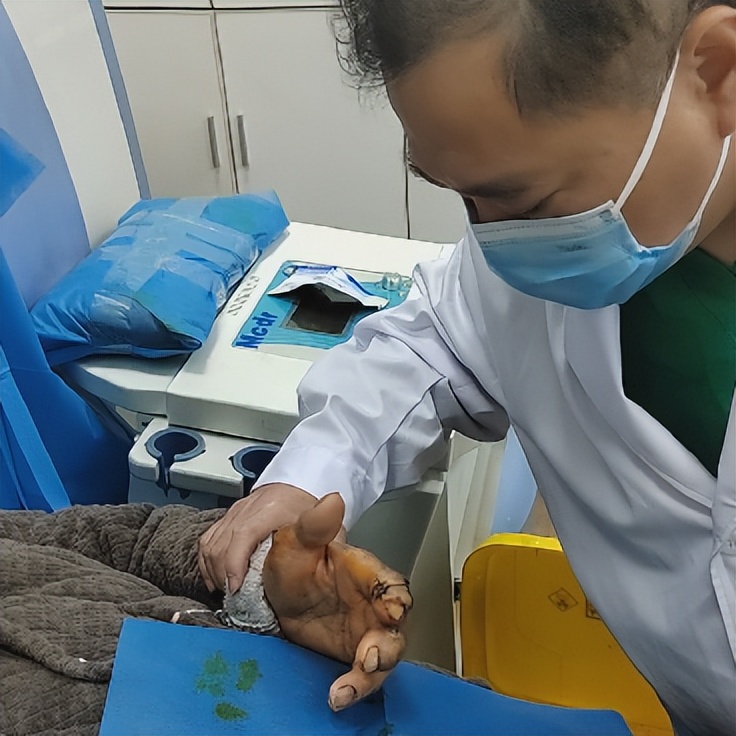 重庆市痛风专家高锋,高锋医生