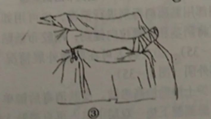 外科手术消毒、铺巾操作，做好这几个细节事半功倍