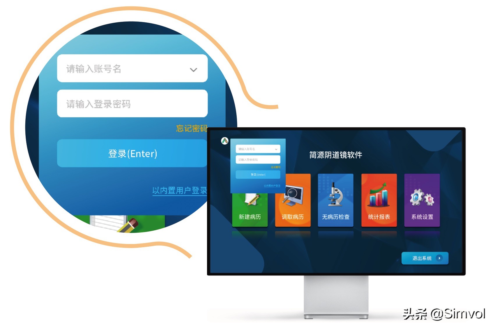 阴道镜的软实力——简源阴道镜软件