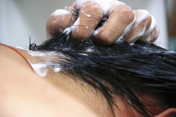 头皮屑大块大块的掉应该怎么治疗,头皮屑大块掉什么原因造成的