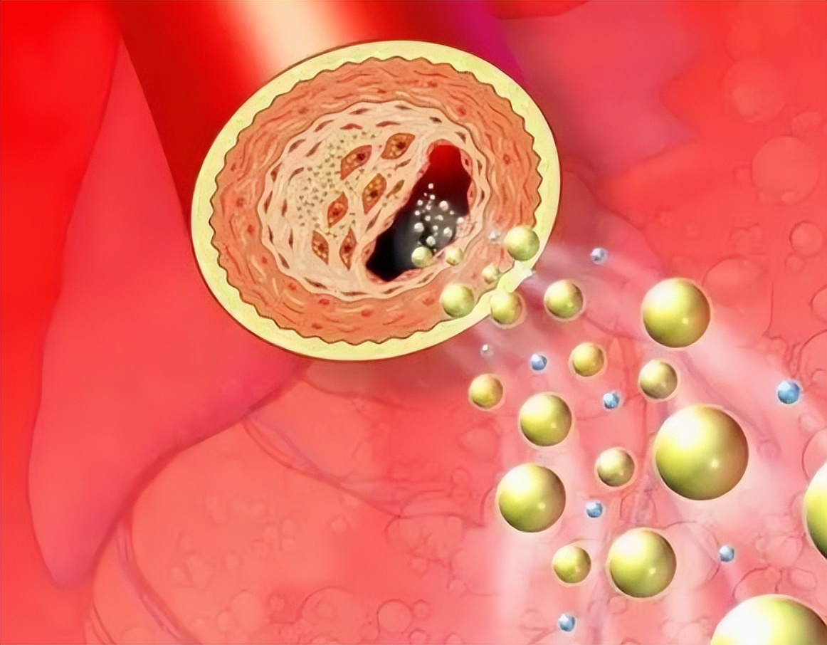 天然含叶酸食物有哪些,含天然叶酸食物有哪些