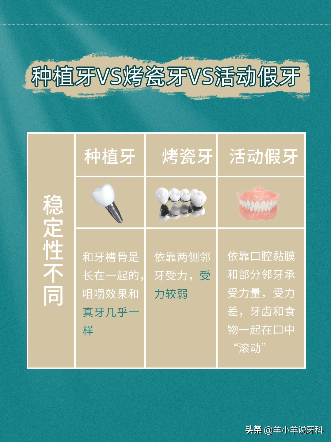 牙齿先天性缺失的修复多少钱,女童牙齿缺失应该怎么修复