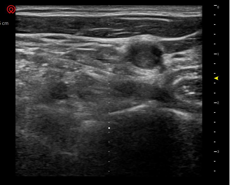 疼痛难忍最好的治疗方法,疼痛难忍的治疗