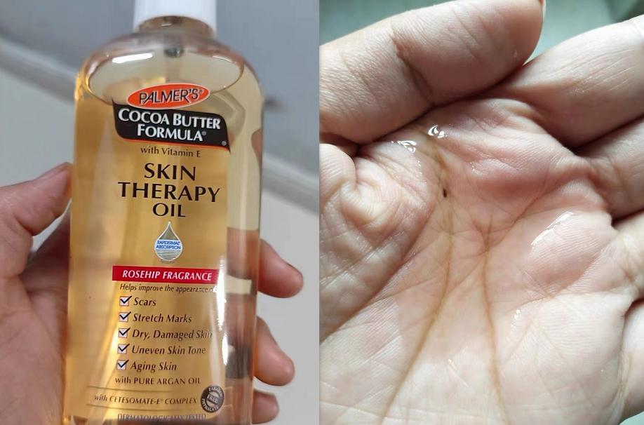 消除妊娠纹是不是智商税,妊娠纹产品是智商税吗