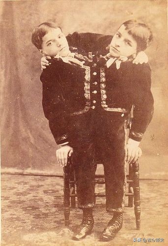 连体人结婚生子,连体人如何生子