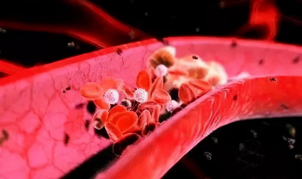 怎么护血管养血管,养心通血管最好的食物