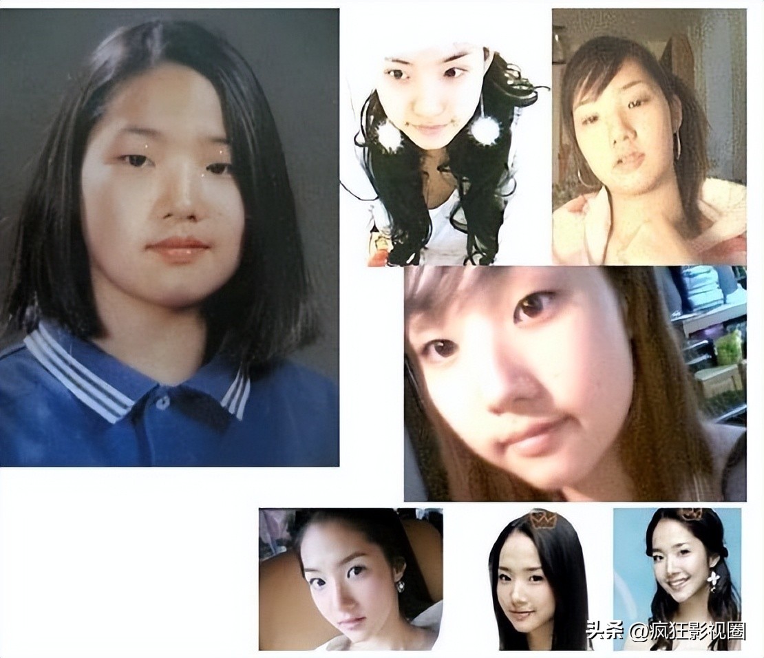 韩国整容最成功的明星朴敏英,朴敏英自曝整容史