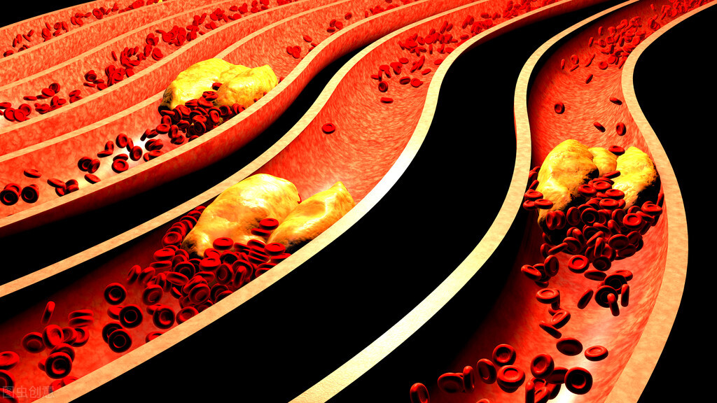 化瘀化解血液斑块的最好的中成药,活血化瘀中成药十大名方