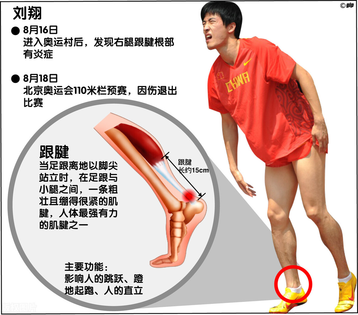 跟腱断裂对运动员的影响,运动员跟腱疼痛怎么解决