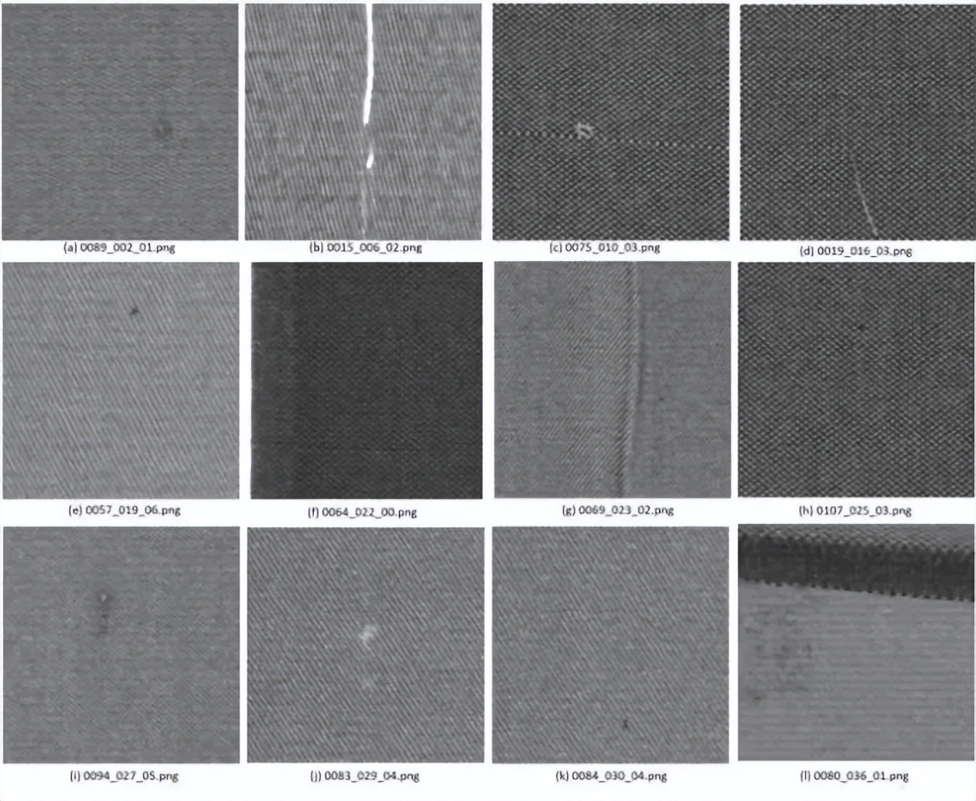 医学影像目标检测框架,开源数据集目标检测
