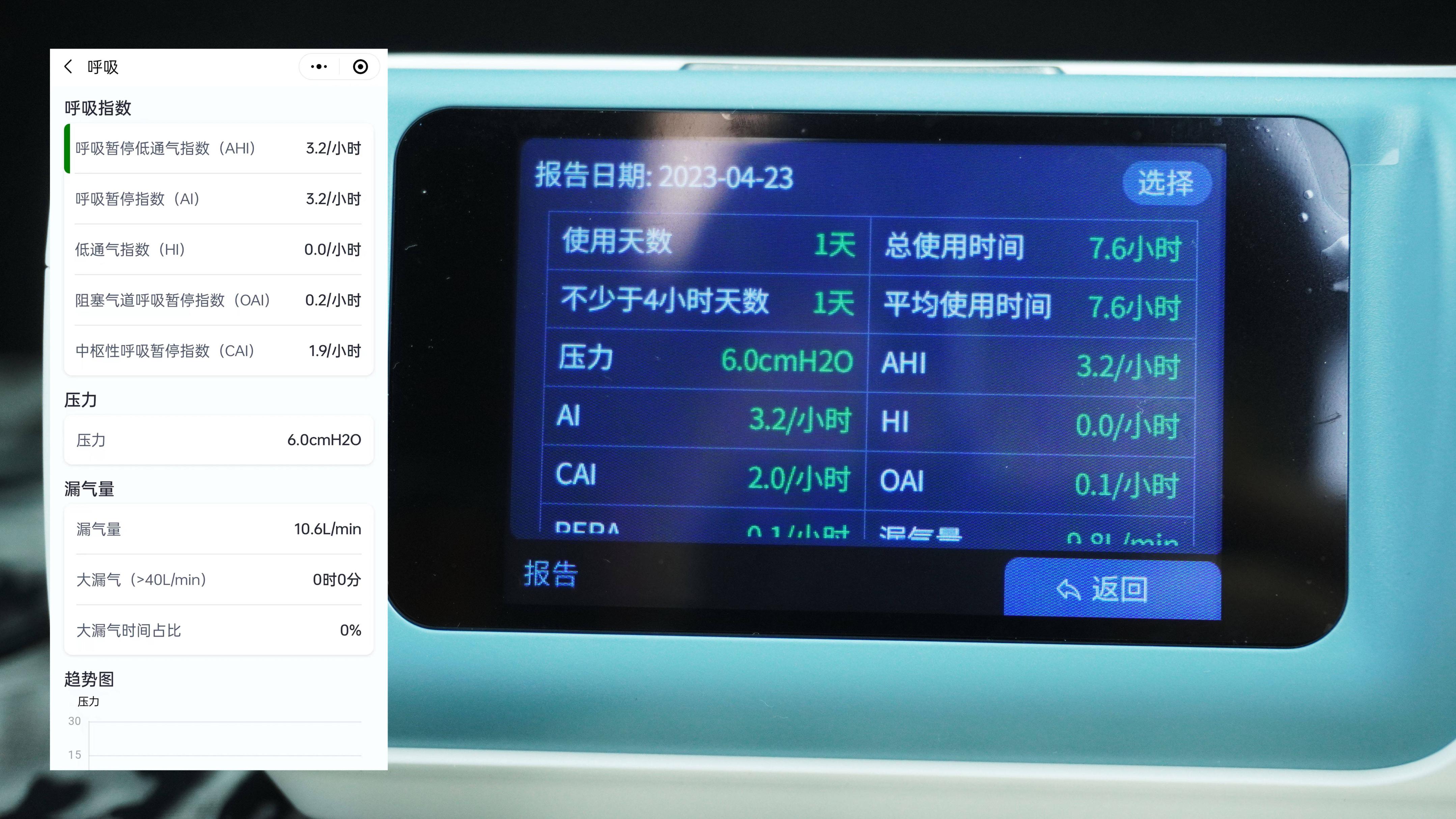 打鼾对健康有影响吗,打鼾影响睡眠质量