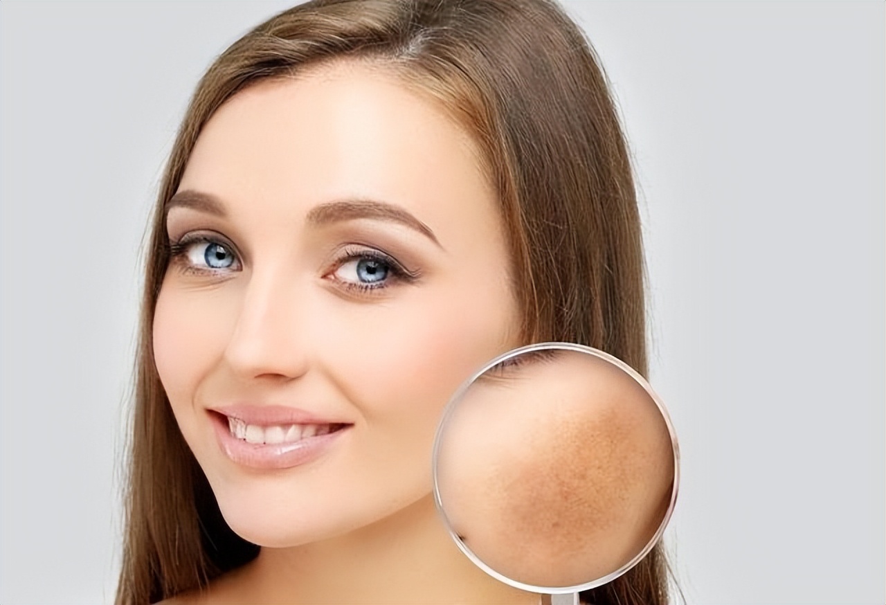 红霉素软膏的淡斑方法小妙招,2元钱的红霉素软膏能治疗什么病