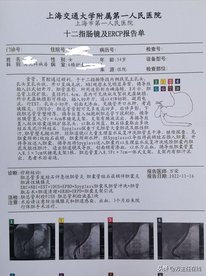 胆结石化脓性胆囊炎,妙手神针巧治疑难杂症