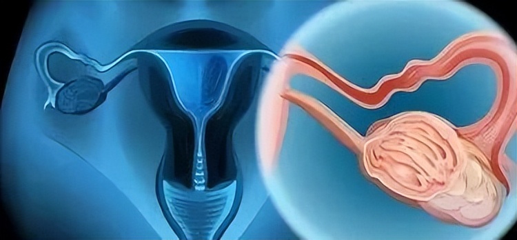 癌症也会“传染”？身边人得了这3种癌，你就要警惕了