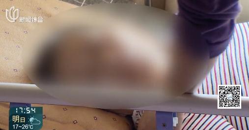 半瘫老人能办残疾证吗,办理精神残疾证监护人必须到场吗