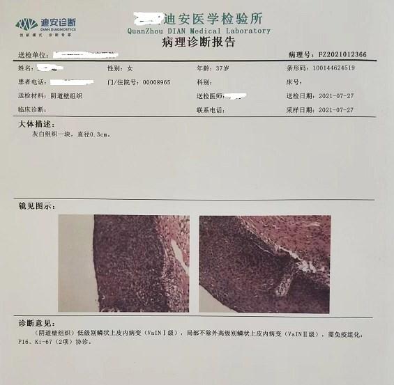 治疗hpv高危持续感染的临床研究,治疗hpv高危感染的科普文章