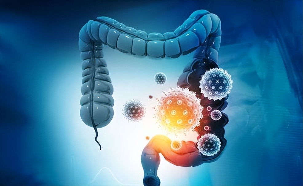 放屁多老放屁是肝癌的前兆吗,放屁多是肝癌的前兆吗