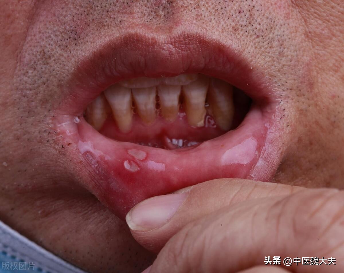 缺乏维生素b2人体会出现哪些症状,人体缺乏维生素b2什么症状