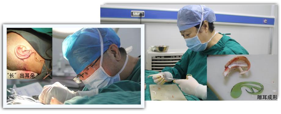 小耳畸形整形医院哪个好,北京八大处耳畸形整形医院