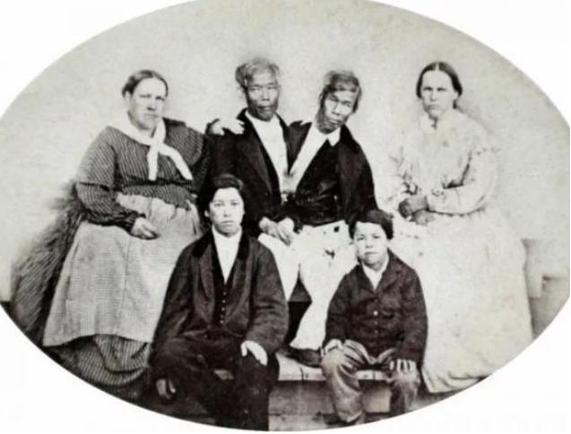 泰国连体兄弟娶美国姐妹,泰国连体兄弟娶双胞胎姐妹