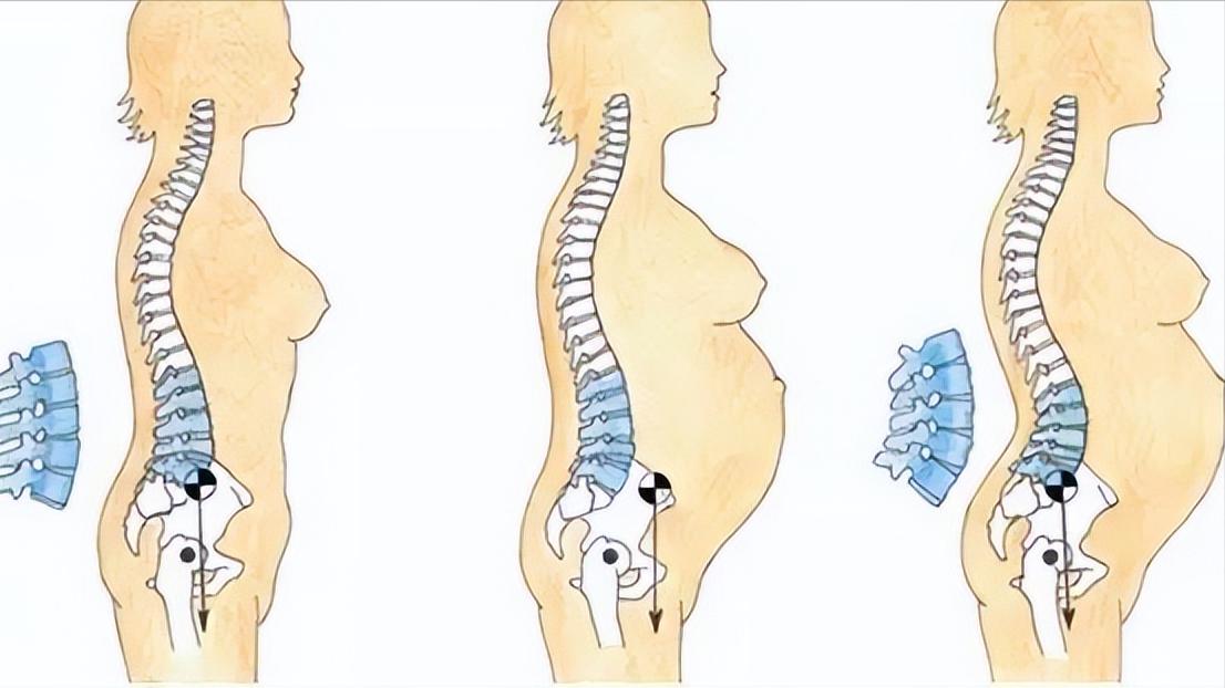 一直保持正确坐姿不得脊椎病吗,腰背挺直的正确姿势