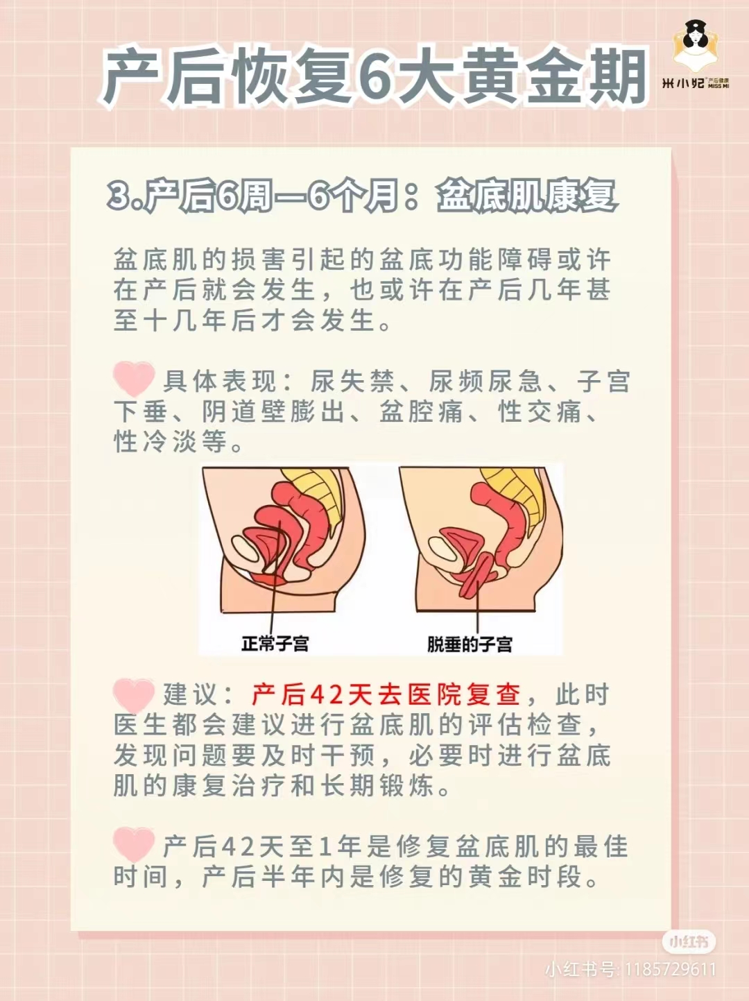 产后恢复的黄金期与注意事项,产后恢复黄金三项是哪些