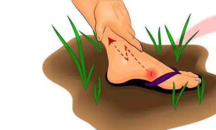 铁钉扎到脚要打破伤风吗,被铁钉扎了一下一定要打破伤风吗