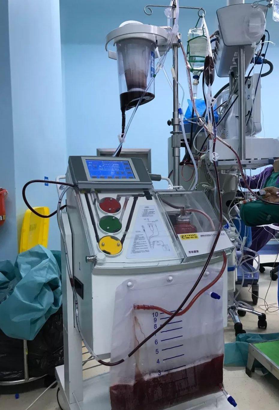 以血型鉴定亲子关系有法律效益么,通过血型判断亲生关系