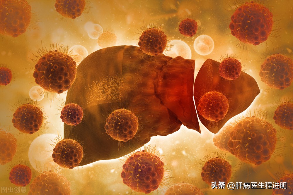 乙肝抗病毒治疗开始了就不能停吗,乙肝抗病毒药病毒降不下来怎么办