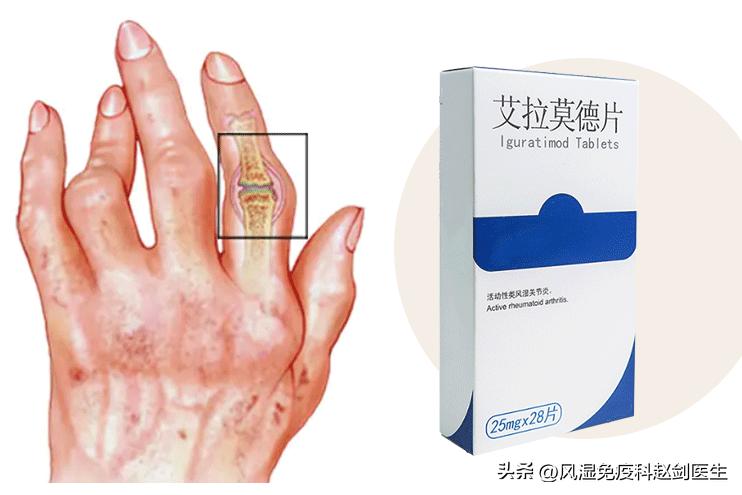 艾拉莫德治疗风湿病效果怎么样,艾拉莫德治疗类风湿效果好吗